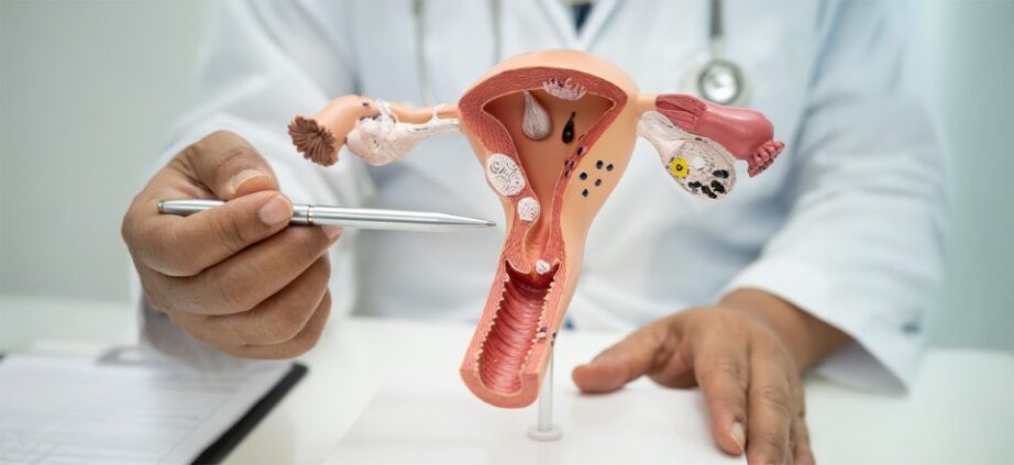 Vaginal Issues